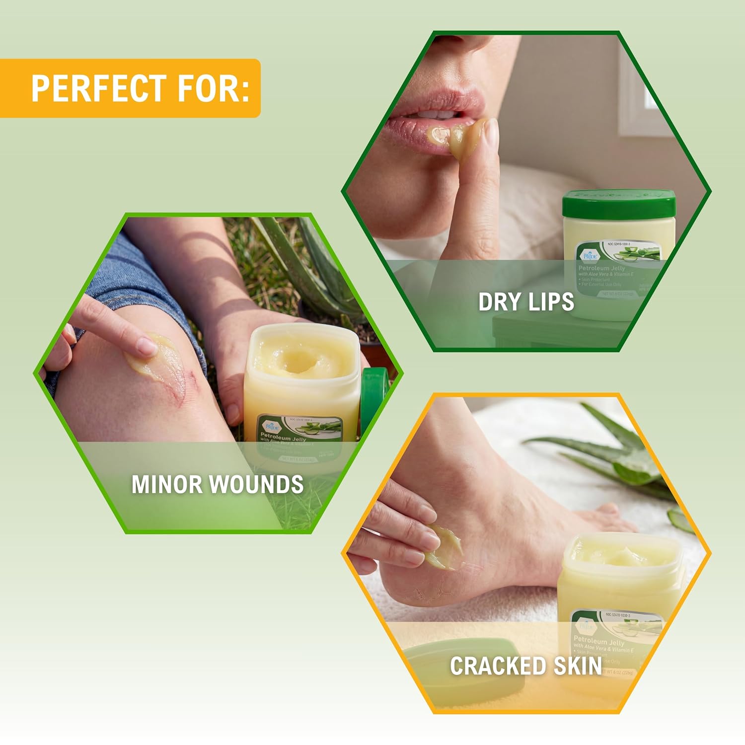 MED PRIDE Aloe Vera Vitamin E Petroleum Jelly Skin Ointment