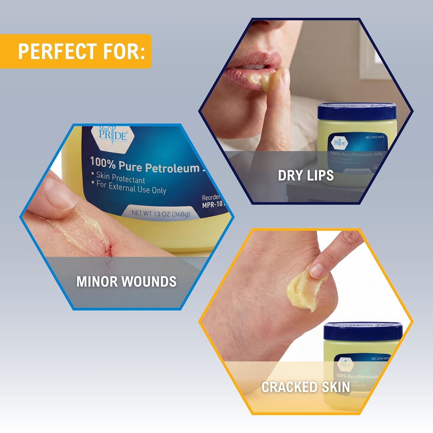 Med Pride Pure White Petroleum Jelly Skin Protectant 13oz