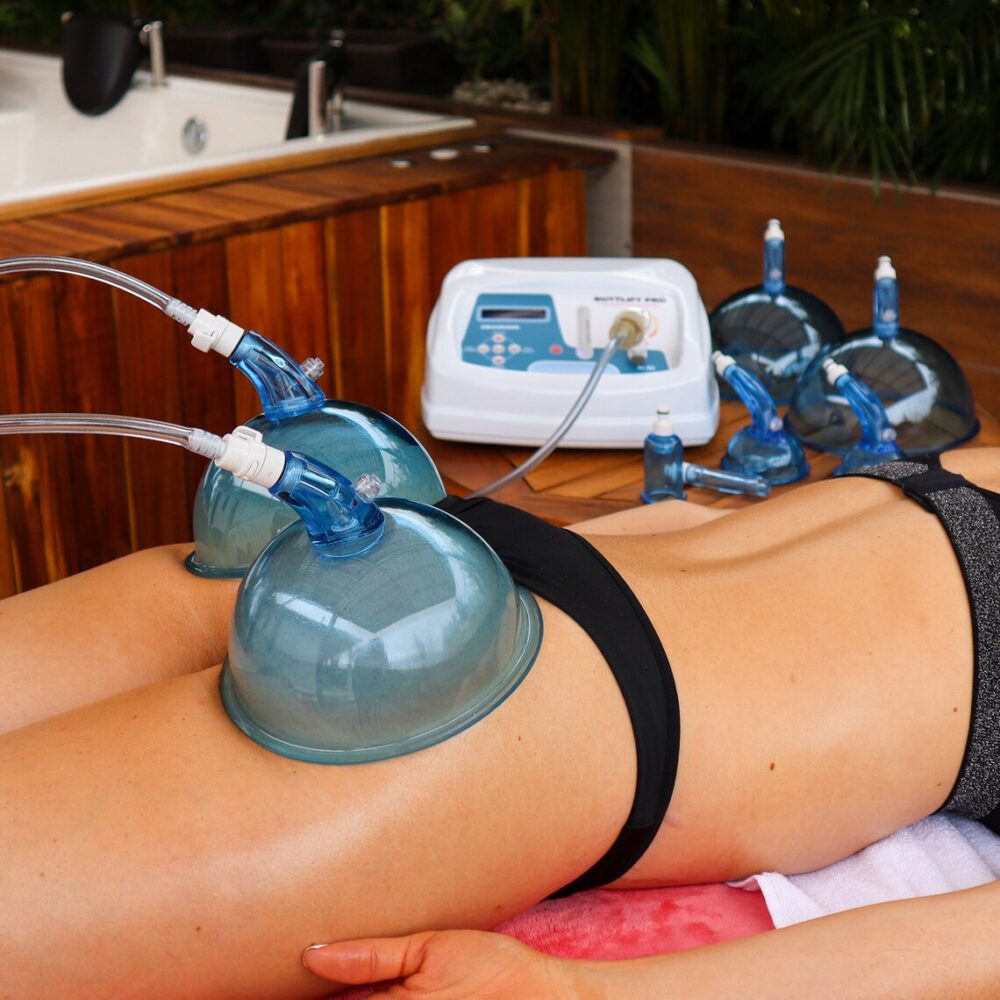 Person receiving cupping therapy with multiple cups on a wooden bench.